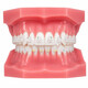 Perfect Clear, сапфірові брекети Roth 018, 022, низ 5-5 